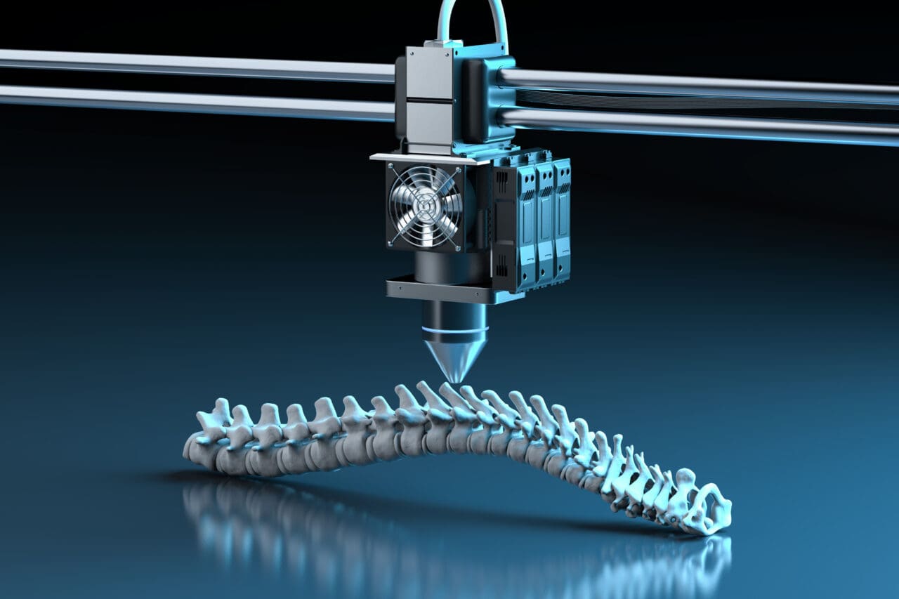 3d rendering 3d printer print prosthetic spine